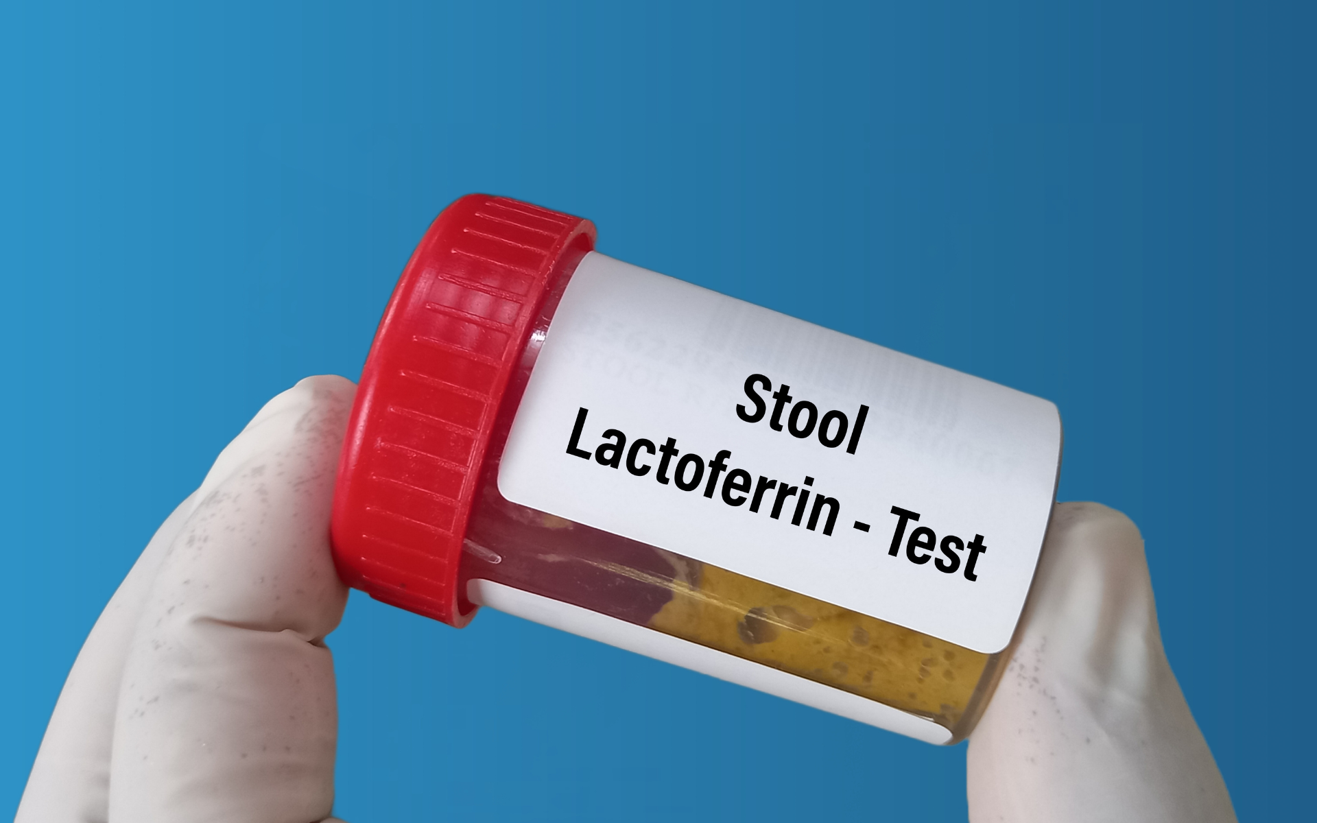 leczenie i diagnozowanie IBS
